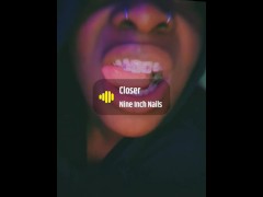 Braces update!!!!!!! - Screenshot 2 of 16 - Braces