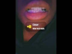 Braces update!!!!!!! - Screenshot 4 of 16 - Short Girl