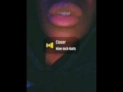 Braces update!!!!!!! - Screenshot 5 of 16 - Big Lips