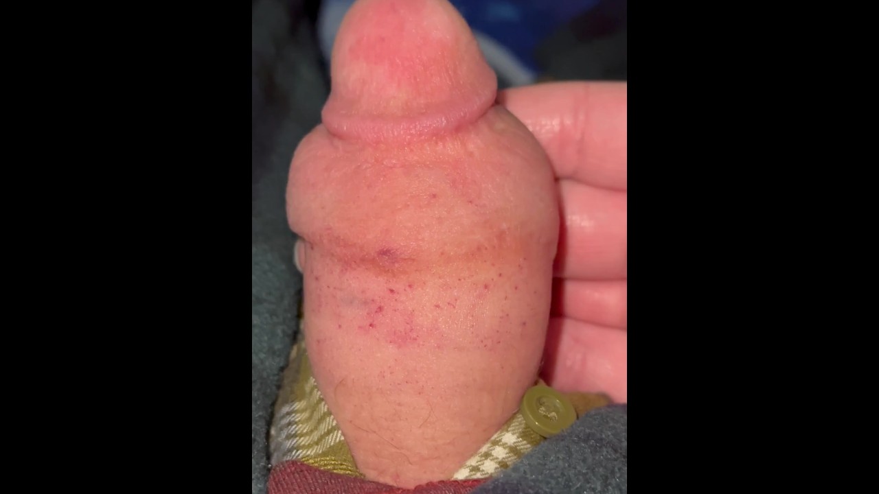 Penis pump fail. 4K 120 FPS 13