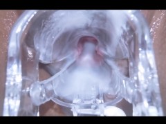 Pinay Speculum Gaping Pussy