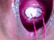 Preview 3 of 2 tampones in cervix extrem