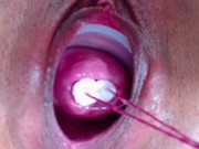 Preview 6 of 2 tampones in cervix extrem