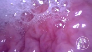 内部POV:空気で膀胱を膨らませる-プレビュー