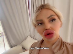 Biggest fake Lips on the WORLD