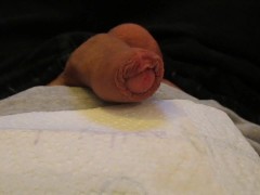 Masturbe (287) with one testicle