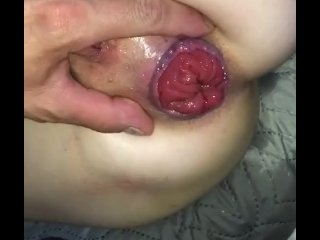Anal dildo prolapse squirt big ass Video