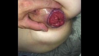 Anal dildo prolapse squirt big ass