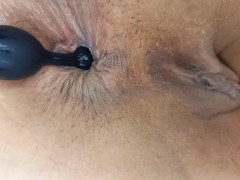 The play of my anus - Screenshot 5 of 16 - Anus