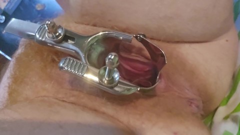 Need bigger speculum