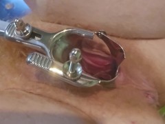 Need bigger speculum