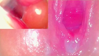 Camera in echte, roze vagina neemt enorme creampie op (baarmoederhals POV) - Koppel Keyla & Lucas