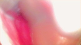 真实粉色阴道摄像头记录大量中出（子宫颈 POV）- 年轻夫妇 Keyla 和 Lucas