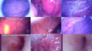 COMPILATION : Endoscope dans ma bite, mon cul et ma vessie