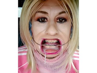 Headgear braces fetish featuring Alexandra Braces Video