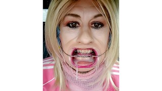 Appareil dentaire fétiche avec Alexandra bretelles