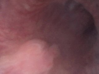 Endoscope internal emissions from ejaculatory duct