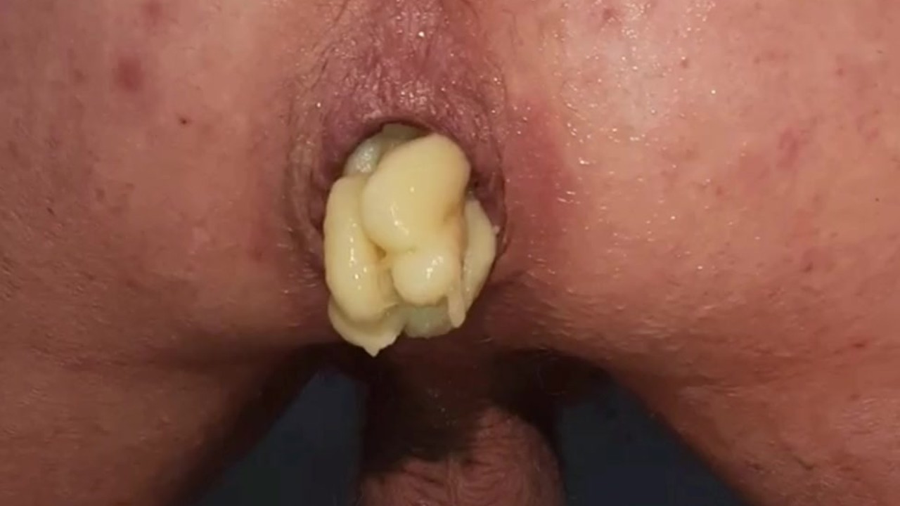 хенттай личинки 