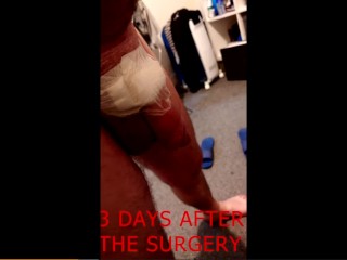 My Cock Enlargement Surgery for £8495
