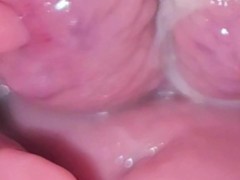 Exploring my vulva - Screenshot 10 of 16 - Extreme Pussy Gape
