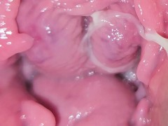 Exploring my vulva - Screenshot 16 of 16 - Open Pussy