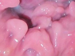 Exploring my vulva - Screenshot 5 of 16 - Pussy Gape