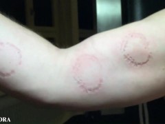 FemDom Biting Mistress Gets Her Teeth into her Sub - Deep Bites and Teeth Marks