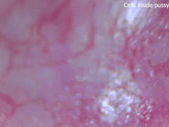 Cells moving inside pussy vessels!