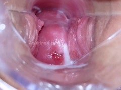 Cervix Display and Speculum Play - Screenshot 10 of 16 - Camera In Vagina