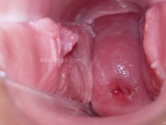 Cervix Display and Speculum Play - Screenshot 4 of 16 - Pussy Contractions