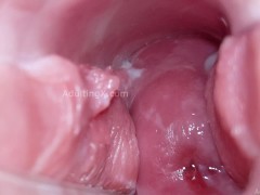 Cervix Display and Speculum Play - Screenshot 5 of 16 - Camera In Vagina