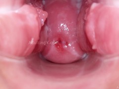 Cervix Display and Speculum Play - Screenshot 6 of 16 - Cervix