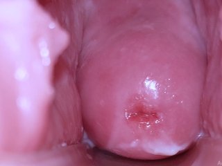 Screen Capture of Video Titled: Cervix Display and Speculum Play