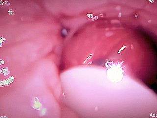Condom "creampie" Camera in Vagina