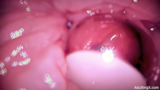 Condom Creampie Camera In Vagina