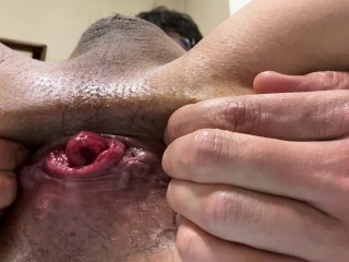 I think i'm almost able to do Anal Rose.
