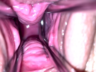 Fetish Gyno Vid с дрочкой спермой