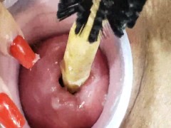 dilating my cervix up close