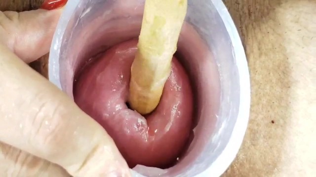расширение шейки матки вблизи
