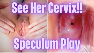 Cervix Close-Up With A Speculum To View Her Pussy Inside