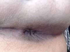 Extreme Closeup Asshole Hairy Blue Fingernails