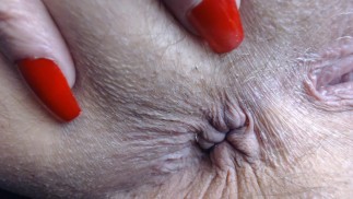 Arschloch Extreme Nahaufnahme Behaarte Rote Fingernägel
