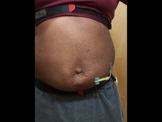 N2O Belly Inflation