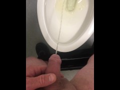 My Doctor Requested Another Urine Sample, I almost wanted to give a little semen too