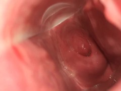 showing my open cervix