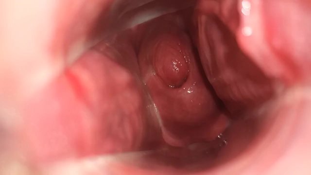 showing my open cervix