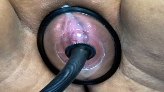 Muschipumpe bringt Stiefschwester zum Schreien