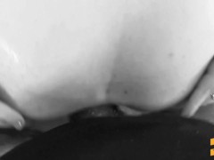 Anal Prolapse With Tampon in Pussy