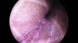 Dildo Camera Explores Close Up Cervix