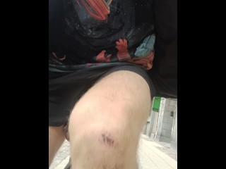 Публичный вызов - мигающие яички с носилками